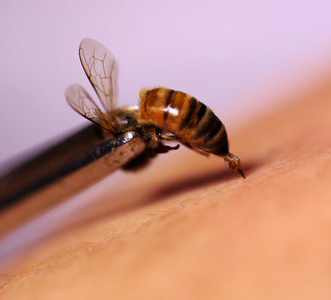 BEE VENOM THERAPY - AN OVERVIEW